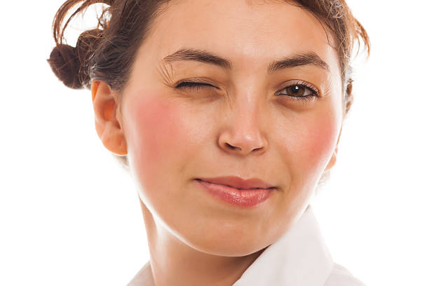 Aerolase for Rosacea and Redness in Reno at Bella Derma