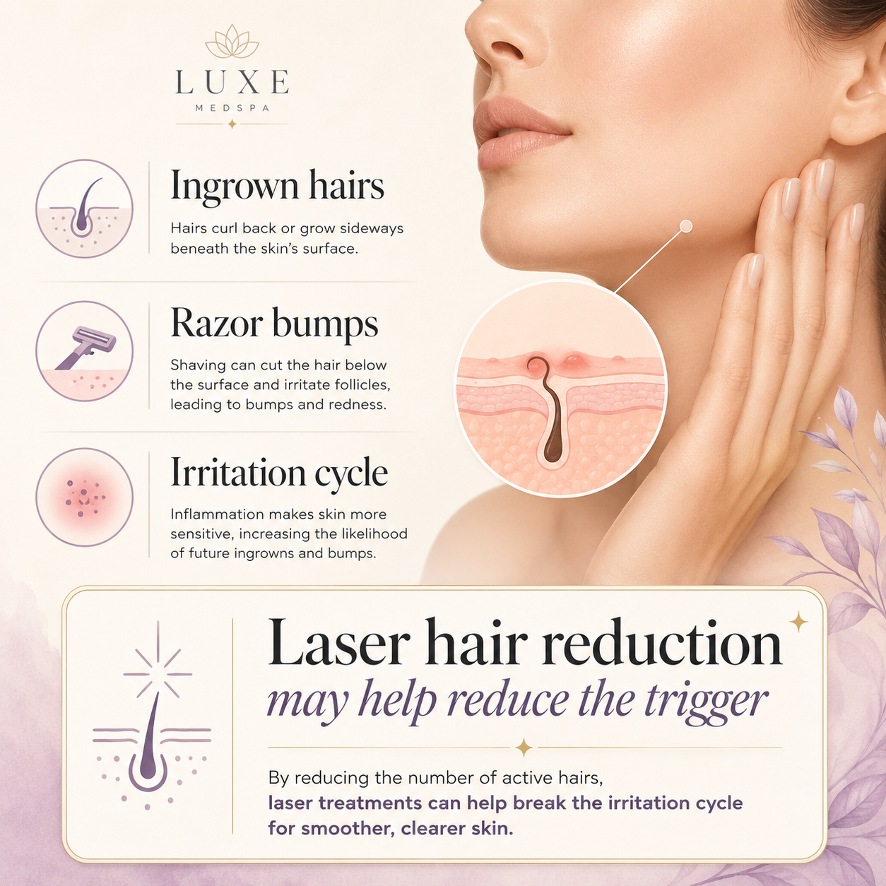 Aerolase Laser Hair Removal in Reno for ingrown hairs