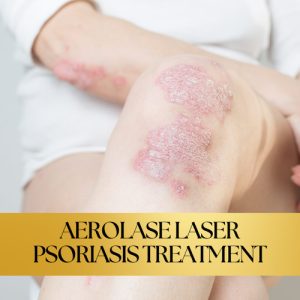 Aerolase laser therapy for plaque psoriasis in Reno