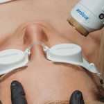 Aerolase Laser Treatment in Reno