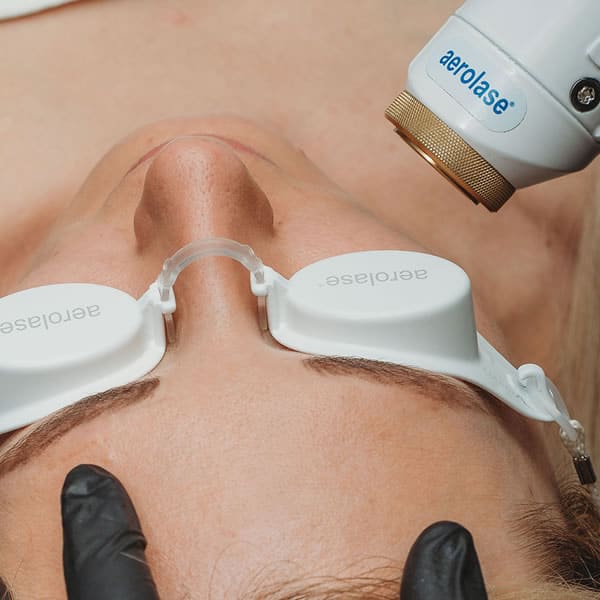 Aerolase Laser Treatment in Reno