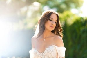 Botox Before a Wedding Reno Tahoe: The Perfect Timing Guide for Photoshoots and Major Events 2 Botox before engagement photos Reno Tahoe