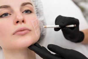 Conservative Botox treatment planning with skilled Reno injector