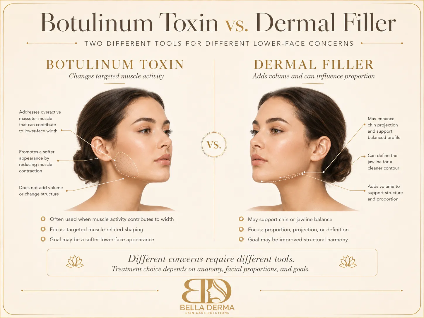 Botox versus dermal filler for jawline slimming and facial balancing in Reno