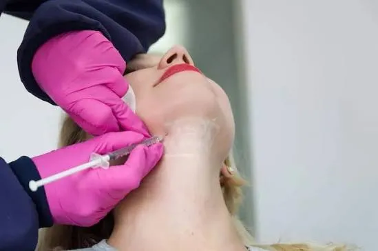 Kybella in Reno treatment planning and injection-area image